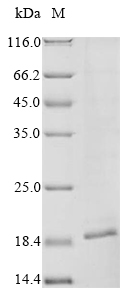 (Tris-Glycine gel) Discontinuous SDS-PAGE (reduced) with 5% enrichment gel and 15% separation gel. (Tris-Glycine gel) Discontinuous SDS-PAGE (reduced) with 5% enrichment gel and 15% separation gel.