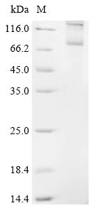 Recombinant Rat Follicle-stimulating hormone receptor (Fshr) - image 1