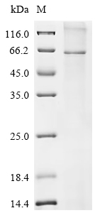 Recombinant Human Glucagon-like peptide 2 receptor (GLP2R) - image 1