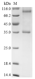 Recombinant Rat Chemerin-like receptor 2 (Cmklr2) - image 1