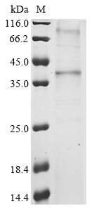(Tris-Glycine gel) Discontinuous SDS-PAGE (reduced) with 5% enrichment gel and 15% separation gel. (Tris-Glycine gel) Discontinuous SDS-PAGE (reduced) with 5% enrichment gel and 15% separation gel.