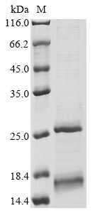 (Tris-Glycine gel) Discontinuous SDS-PAGE (reduced) with 5% enrichment gel and 15% separation gel. (Tris-Glycine gel) Discontinuous SDS-PAGE (reduced) with 5% enrichment gel and 15% separation gel.