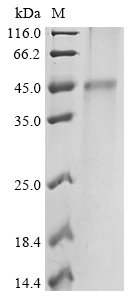 (Tris-Glycine gel) Discontinuous SDS-PAGE (reduced) with 5% enrichment gel and 15% separation gel. (Tris-Glycine gel) Discontinuous SDS-PAGE (reduced) with 5% enrichment gel and 15% separation gel.