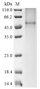 (Tris-Glycine gel) Discontinuous SDS-PAGE (reduced) with 5% enrichment gel and 15% separation gel. (Tris-Glycine gel) Discontinuous SDS-PAGE (reduced) with 5% enrichment gel and 15% separation gel.