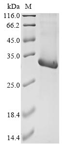 (Tris-Glycine gel) Discontinuous SDS-PAGE (reduced) with 5% enrichment gel and 15% separation gel. (Tris-Glycine gel) Discontinuous SDS-PAGE (reduced) with 5% enrichment gel and 15% separation gel.