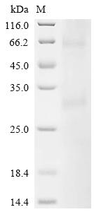 Recombinant Human Melanocortin receptor 4 (MC4R) - image 1
