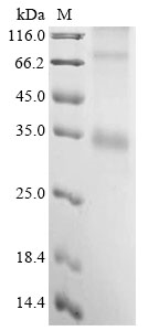 (Tris-Glycine gel) Discontinuous SDS-PAGE (reduced) with 5% enrichment gel and 15% separation gel. (Tris-Glycine gel) Discontinuous SDS-PAGE (reduced) with 5% enrichment gel and 15% separation gel.