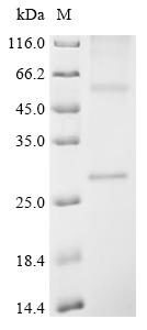 Recombinant Human Lens fiber major intrinsic protein (MIP) - image 1