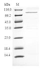 (Tris-Glycine gel) Discontinuous SDS-PAGE (reduced) with 5% enrichment gel and 15% separation gel. (Tris-Glycine gel) Discontinuous SDS-PAGE (reduced) with 5% enrichment gel and 15% separation gel.