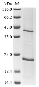 (Tris-Glycine gel) Discontinuous SDS-PAGE (reduced) with 5% enrichment gel and 15% separation gel. (Tris-Glycine gel) Discontinuous SDS-PAGE (reduced) with 5% enrichment gel and 15% separation gel.