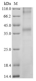 Recombinant Human Long-wave-sensitive opsin 1 (OPN1LW) - image 1