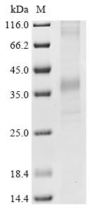 Recombinant Human Delta-type opioid receptor (OPRD1) - image 1