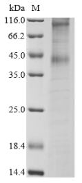 (Tris-Glycine gel) Discontinuous SDS-PAGE (reduced) with 5% enrichment gel and 15% separation gel. (Tris-Glycine gel) Discontinuous SDS-PAGE (reduced) with 5% enrichment gel and 15% separation gel.