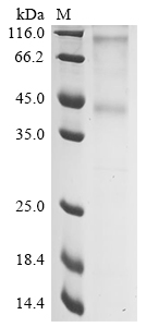 (Tris-Glycine gel) Discontinuous SDS-PAGE (reduced) with 5% enrichment gel and 15% separation gel. (Tris-Glycine gel) Discontinuous SDS-PAGE (reduced) with 5% enrichment gel and 15% separation gel.