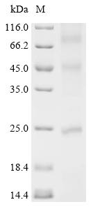 (Tris-Glycine gel) Discontinuous SDS-PAGE (reduced) with 5% enrichment gel and 15% separation gel.