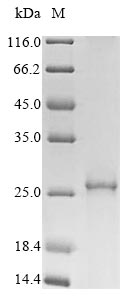 (Tris-Glycine gel) Discontinuous SDS-PAGE (reduced) with 5% enrichment gel and 15% separation gel. (Tris-Glycine gel) Discontinuous SDS-PAGE (reduced) with 5% enrichment gel and 15% separation gel.