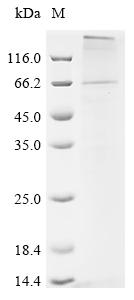 Recombinant Pig Parathyroid hormone/parathyroid hormone-related peptide receptor (PTH1R) - image 1