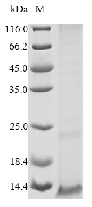 (Tris-Glycine gel) Discontinuous SDS-PAGE (reduced) with 5% enrichment gel and 15% separation gel. (Tris-Glycine gel) Discontinuous SDS-PAGE (reduced) with 5% enrichment gel and 15% separation gel.