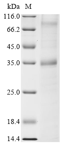 Recombinant Rat Sphingosine 1-phosphate receptor 2 (S1pr2) - image 1