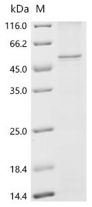 Recombinant Human Secretin receptor (SCTR) - image 1