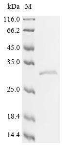 Recombinant Human ADP/ATP translocase 1 (SLC25A4) - image 1