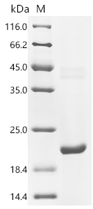 Recombinant Human Sodium-dependent phosphate transport protein 2B (SLC34A2) , partial - image 1