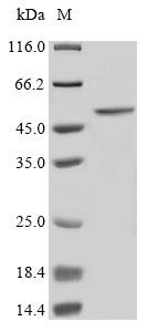 (Tris-Glycine gel) Discontinuous SDS-PAGE (reduced) with 5% enrichment gel and 15% separation gel. (Tris-Glycine gel) Discontinuous SDS-PAGE (reduced) with 5% enrichment gel and 15% separation gel.