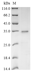 (Tris-Glycine gel) Discontinuous SDS-PAGE (reduced) with 5% enrichment gel and 15% separation gel. (Tris-Glycine gel) Discontinuous SDS-PAGE (reduced) with 5% enrichment gel and 15% separation gel.