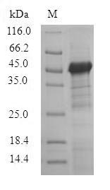 (Tris-Glycine gel) Discontinuous SDS-PAGE (reduced) with 5% enrichment gel and 15% separation gel. (Tris-Glycine gel) Discontinuous SDS-PAGE (reduced) with 5% enrichment gel and 15% separation gel.