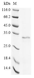 (Tris-Glycine gel) Discontinuous SDS-PAGE (reduced) with 5% enrichment gel and 15% separation gel. (Tris-Glycine gel) Discontinuous SDS-PAGE (reduced) with 5% enrichment gel and 15% separation gel.