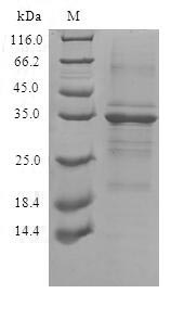 (Tris-Glycine gel) Discontinuous SDS-PAGE (reduced) with 5% enrichment gel and 15% separation gel. (Tris-Glycine gel) Discontinuous SDS-PAGE (reduced) with 5% enrichment gel and 15% separation gel.