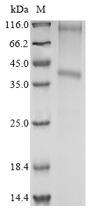 (Tris-Glycine gel) Discontinuous SDS-PAGE (reduced) with 5% enrichment gel and 15% separation gel. (Tris-Glycine gel) Discontinuous SDS-PAGE (reduced) with 5% enrichment gel and 15% separation gel.