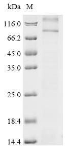 Recombinant Rat Thyrotropin receptor (Tshr) - image 1