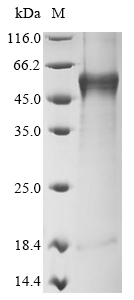 (Tris-Glycine gel) Discontinuous SDS-PAGE (reduced) with 5% enrichment gel and 15% separation gel. (Tris-Glycine gel) Discontinuous SDS-PAGE (reduced) with 5% enrichment gel and 15% separation gel.
