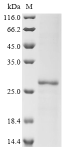 Recombinant Human Uroplakin-2 (UPK2) - image 1