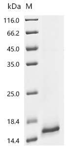 Recombinant Human Uroplakin-2 (UPK2) - image 1