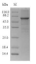 (Tris-Glycine gel) Discontinuous SDS-PAGE (reduced) with 5% enrichment gel and 15% separation gel. (Tris-Glycine gel) Discontinuous SDS-PAGE (reduced) with 5% enrichment gel and 15% separation gel.