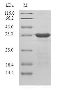 (Tris-Glycine gel) Discontinuous SDS-PAGE (reduced) with 5% enrichment gel and 15% separation gel. (Tris-Glycine gel) Discontinuous SDS-PAGE (reduced) with 5% enrichment gel and 15% separation gel.