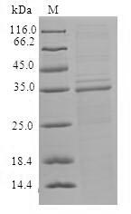 (Tris-Glycine gel) Discontinuous SDS-PAGE (reduced) with 5% enrichment gel and 15% separation gel. (Tris-Glycine gel) Discontinuous SDS-PAGE (reduced) with 5% enrichment gel and 15% separation gel.