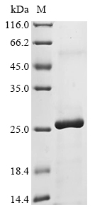 (Tris-Glycine gel) Discontinuous SDS-PAGE (reduced) with 5% enrichment gel and 15% separation gel. (Tris-Glycine gel) Discontinuous SDS-PAGE (reduced) with 5% enrichment gel and 15% separation gel.