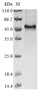 (Tris-Glycine gel) Discontinuous SDS-PAGE (reduced) with 5% enrichment gel and 15% separation gel. (Tris-Glycine gel) Discontinuous SDS-PAGE (reduced) with 5% enrichment gel and 15% separation gel.