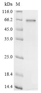 Recombinant Orientia tsutsugamushi 56 KDA type-specific antigen - image 1