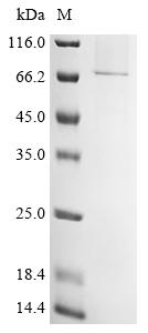 Recombinant Measles virus Hemagglutinin glycoprotein (H) - image 1