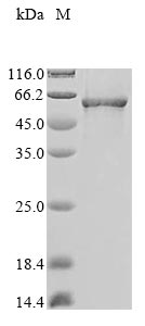 (Tris-Glycine gel) Discontinuous SDS-PAGE (reduced) with 5% enrichment gel and 15% separation gel. (Tris-Glycine gel) Discontinuous SDS-PAGE (reduced) with 5% enrichment gel and 15% separation gel.