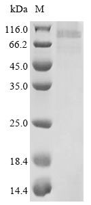 (Tris-Glycine gel) Discontinuous SDS-PAGE (reduced) with 5% enrichment gel and 15% separation gel. (Tris-Glycine gel) Discontinuous SDS-PAGE (reduced) with 5% enrichment gel and 15% separation gel.