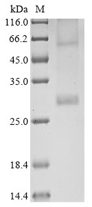 (Tris-Glycine gel) Discontinuous SDS-PAGE (reduced) with 5% enrichment gel and 15% separation gel. (Tris-Glycine gel) Discontinuous SDS-PAGE (reduced) with 5% enrichment gel and 15% separation gel.