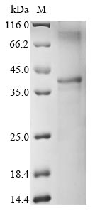 Recombinant Tetranychus urticae Uncharacterized protein - image 1