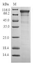 (Tris-Glycine gel) Discontinuous SDS-PAGE (reduced) with 5% enrichment gel and 15% separation gel. (Tris-Glycine gel) Discontinuous SDS-PAGE (reduced) with 5% enrichment gel and 15% separation gel.