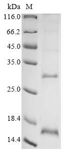 Recombinant Influenza A virus Matrix protein 2 (M) - image 1