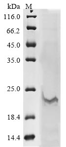 Recombinant Influenza A virus Matrix protein 2 (M2) - image 1